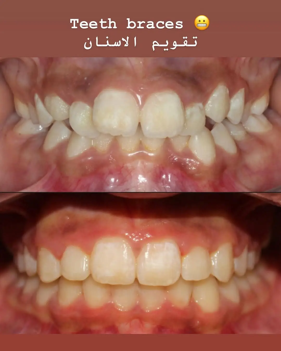 The Dental Hub clinic — dental procedure