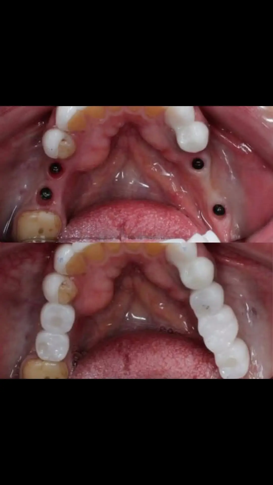 The Dental Hub clinic — sterilization and hygiene